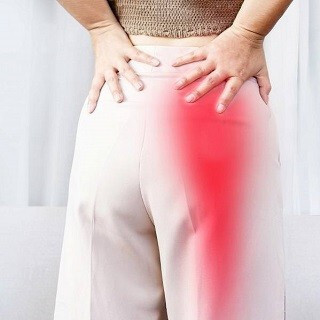 Iskiassmerter: Årsager, symptomer og den bedste behandling